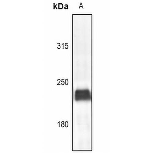 Myosin 6 Rabbit Polyclonal Antibody