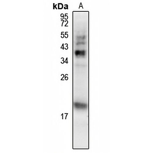 MCH Rabbit Polyclonal Antibody