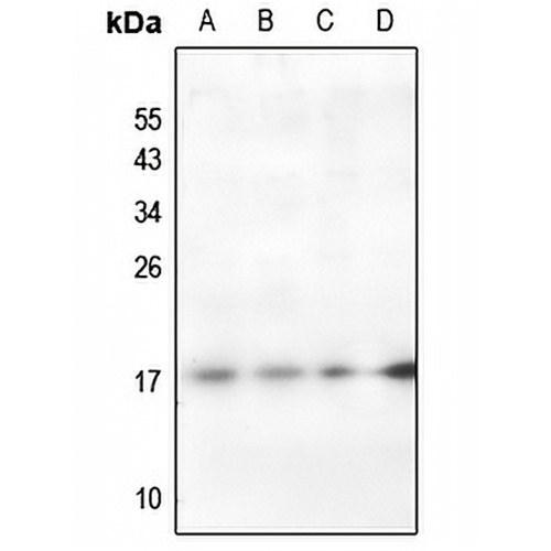 Histone H2A (Acetyl-K95) Rabbit Polyclonal Antibody