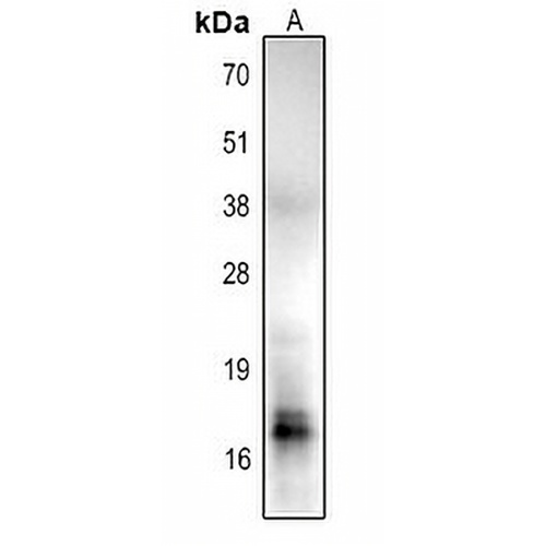 Histone H2B (Acetyl-K85) Rabbit Polyclonal Antibody