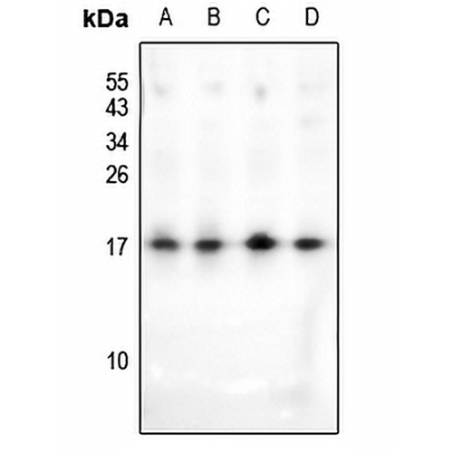 HMGN2 (Acetyl-K31) Rabbit Polyclonal Antibody