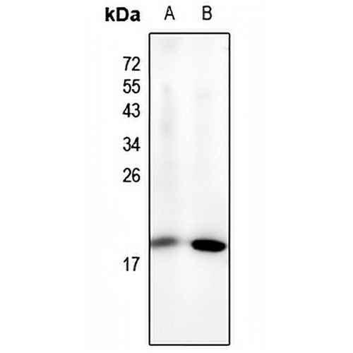 NF-E4 (Acetyl-K43) Rabbit Polyclonal Antibody