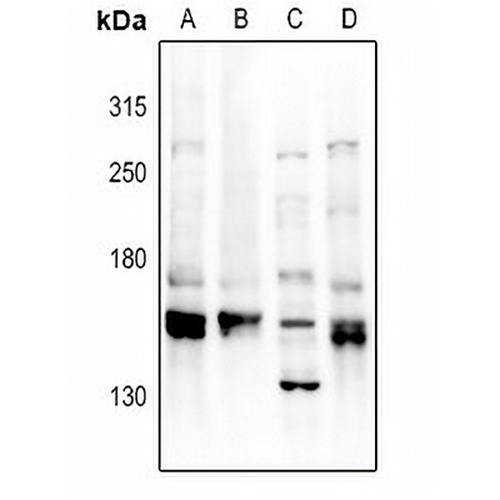 YEATS2 Rabbit Polyclonal Antibody