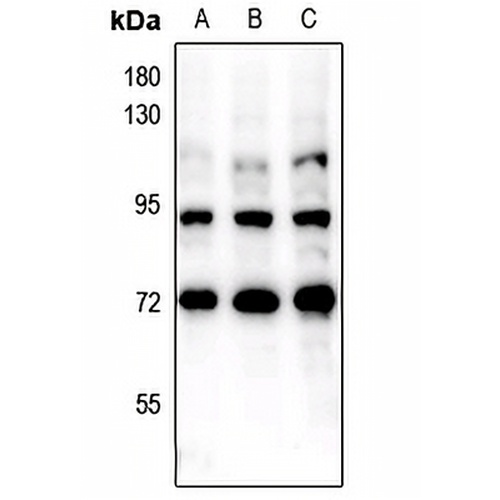 FOXO1/3 (Phospho-S322+S325/pS318+S321) Rabbit Polyclonal Antibody