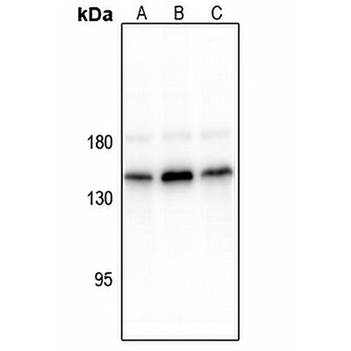 CD117 (Phospho-Y936) Rabbit Polyclonal Antibody