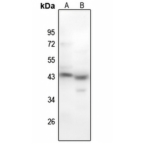 MYOD1 (Phospho-S200) Rabbit Polyclonal Antibody