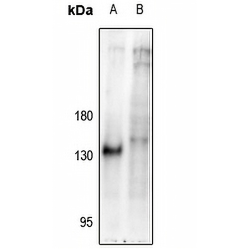 NFAT1 (Phospho-S326) Rabbit Polyclonal Antibody