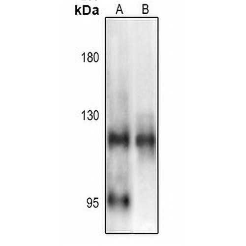 NF-kappaB p105 (Phospho-S903) Rabbit Polyclonal Antibody