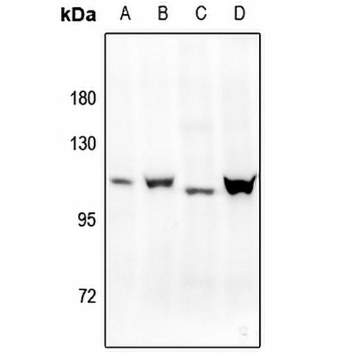 Progesterone Receptor (Phospho-S400) Rabbit Polyclonal Antibody