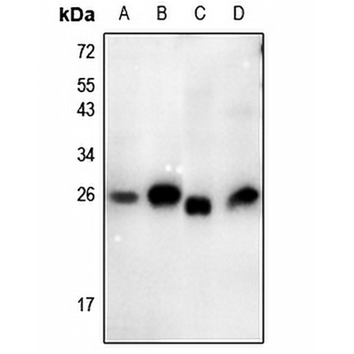 Thymidine Kinase 1 (Phospho-S13) Rabbit Polyclonal Antibody