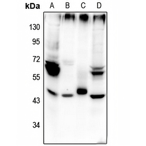 Beta-2 Adrenergic Receptor (Phospho-S355/S356) Rabbit Polyclonal Antibody