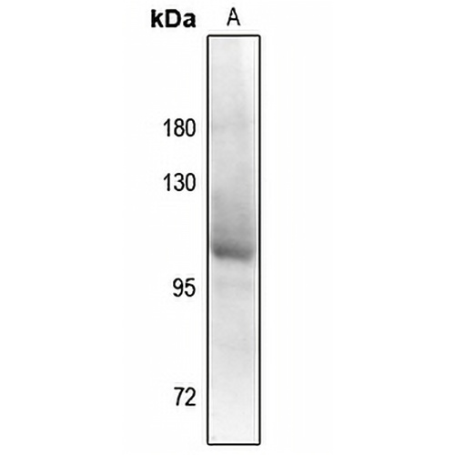 Androgen Receptor (Phospho-S94) Rabbit Polyclonal Antibody