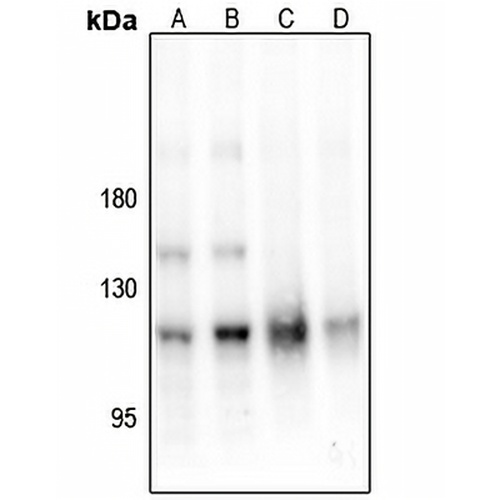 PKC mu (Phospho-S205) Rabbit Polyclonal Antibody