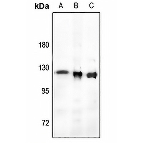 RB1 (Phospho-T821) Rabbit Polyclonal Antibody