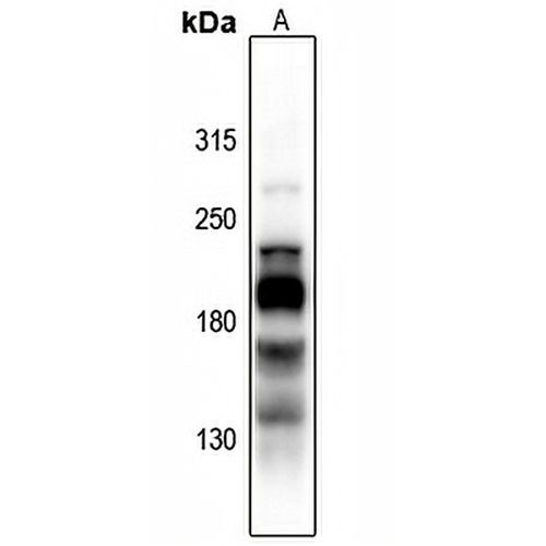 L1CAM (Phospho-S1181) Rabbit Polyclonal Antibody