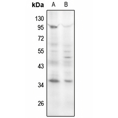 Cyclin D1 (Phospho-S90) Rabbit Polyclonal Antibody