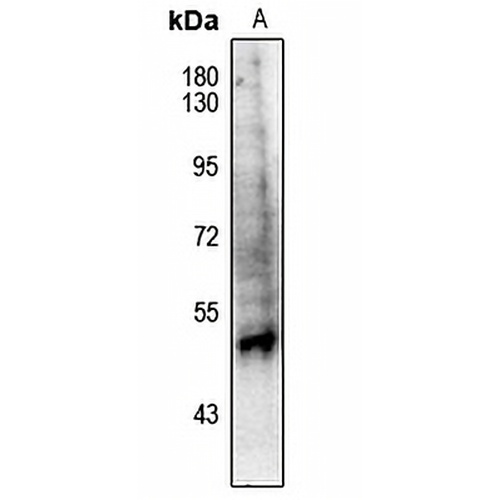 PPAR alpha (Phospho-S21) Rabbit Polyclonal Antibody