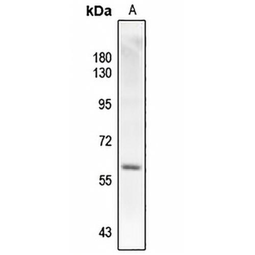 SMAD2 (Phospho-T220) Rabbit Polyclonal Antibody