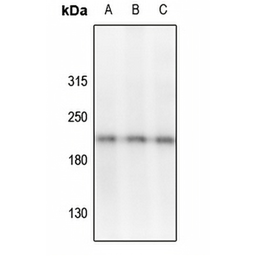 VEGFR2/3 (Phospho-Y1054/Y1063) Rabbit Polyclonal Antibody