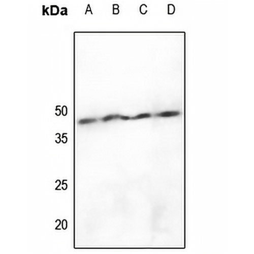 hnRNP D0 (Phospho-S83) Rabbit Polyclonal Antibody