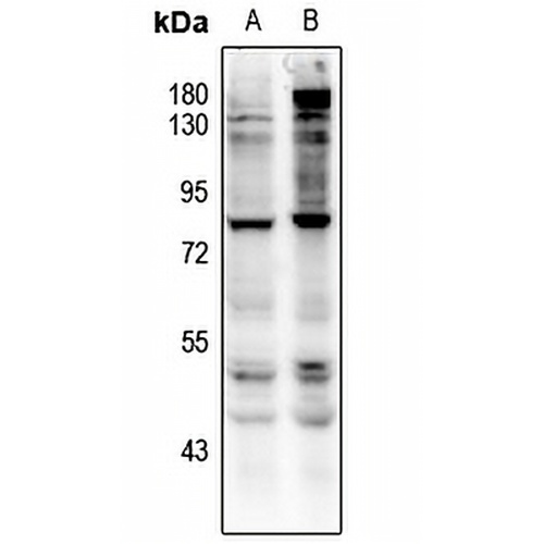 CD127 (Phospho-Y449) Rabbit Polyclonal Antibody