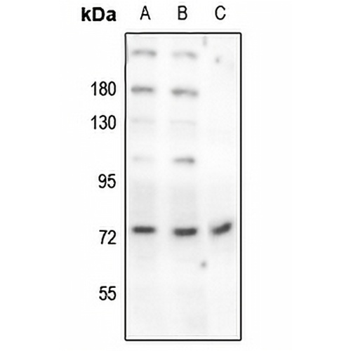 Beta-NaCH (Phospho-T615) Rabbit Polyclonal Antibody