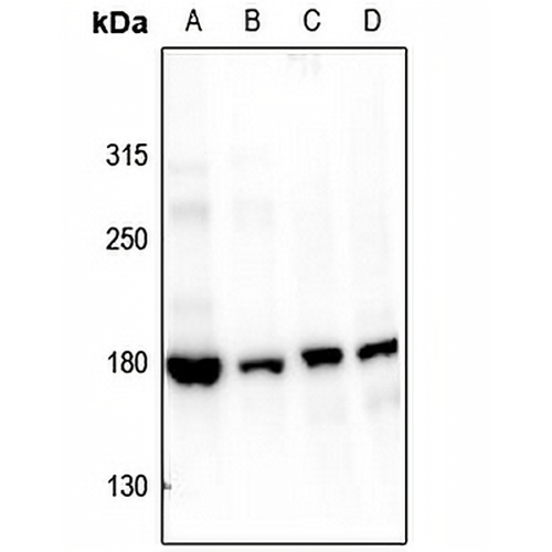 Topoisomerase 2 alpha (Phospho-S1106) Rabbit Polyclonal Antibody