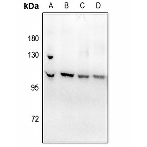 ATP1A1 (Phospho-S23) Rabbit Polyclonal Antibody