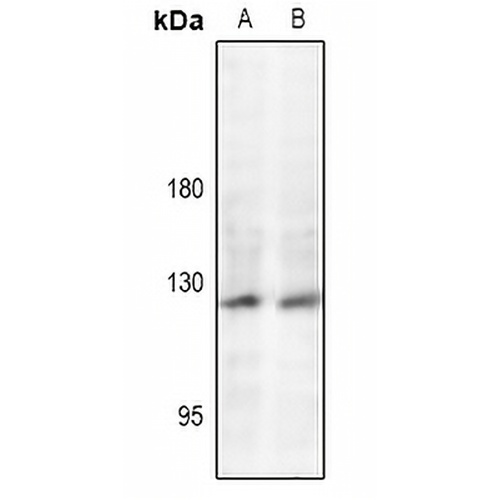 JAK2 (Phospho-Y221) Rabbit Polyclonal Antibody