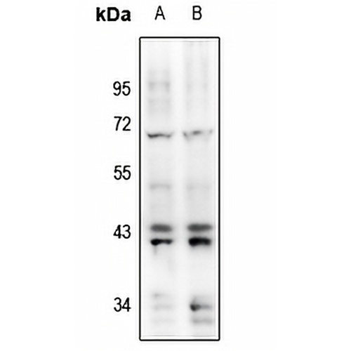 ERK1/2 (Phospho-Y204) Rabbit Polyclonal Antibody