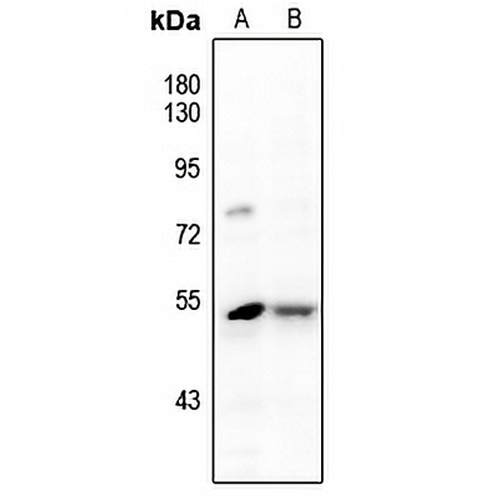 JNK1/2/3 (Phospho-Y185) Rabbit Polyclonal Antibody