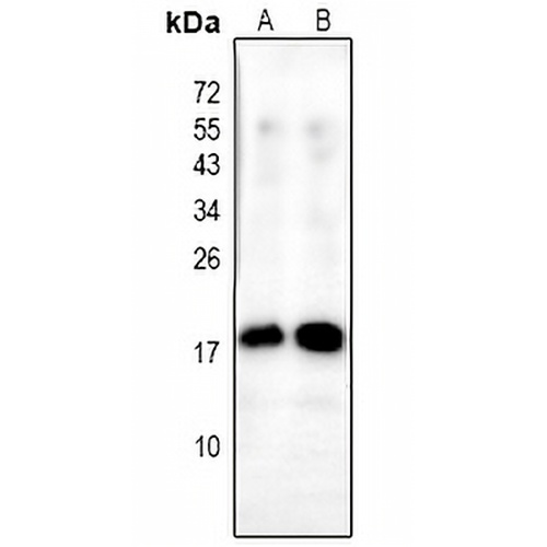 Alpha-synuclein (Phospho-Y136) Rabbit Polyclonal Antibody