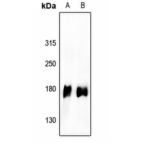 EGFR (Phospho-Y1110) Rabbit Polyclonal Antibody