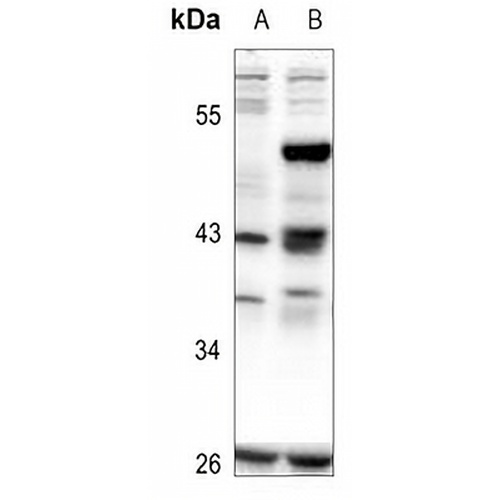 CREB (Phospho-S111) Rabbit Polyclonal Antibody