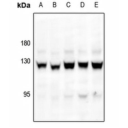 Focal Adhesion Kinase (Phospho-S843) Rabbit Polyclonal Antibody