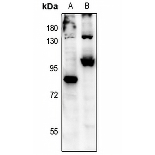 FOXO3 (Phospho-S315) Rabbit Polyclonal Antibody