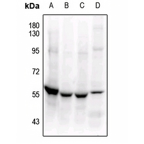 MEF2C Rabbit Polyclonal Antibody