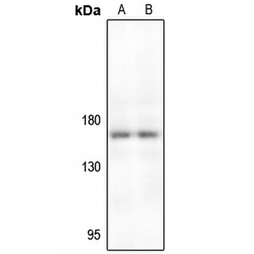 TIE2 Rabbit Polyclonal Antibody