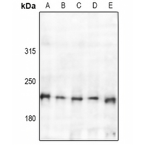TSC2 Rabbit Polyclonal Antibody