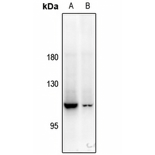 PYK2 Rabbit Polyclonal Antibody