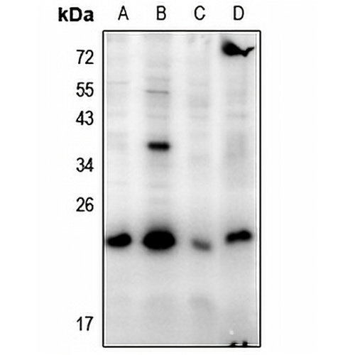 BAD Rabbit Polyclonal Antibody