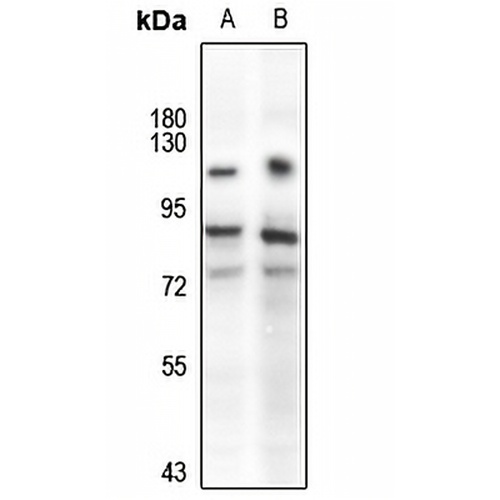 TAU Rabbit Polyclonal Antibody