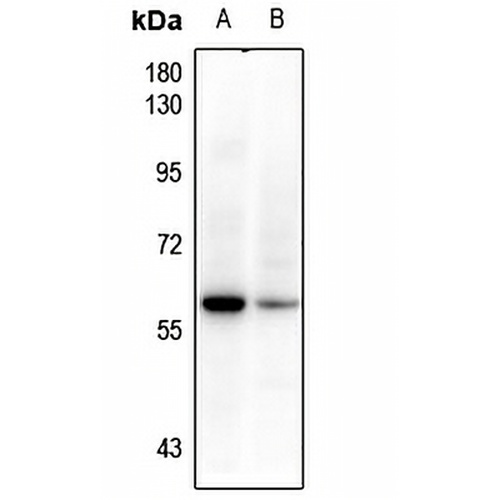 BRK Rabbit Polyclonal Antibody