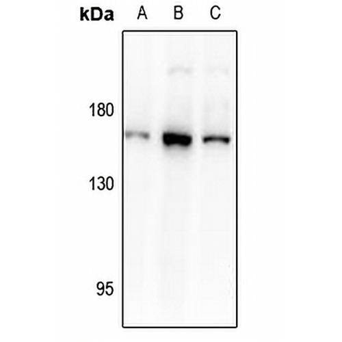 DAP Kinase 1 Rabbit Polyclonal Antibody