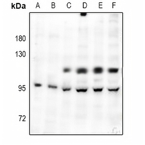 c-FER Rabbit Polyclonal Antibody