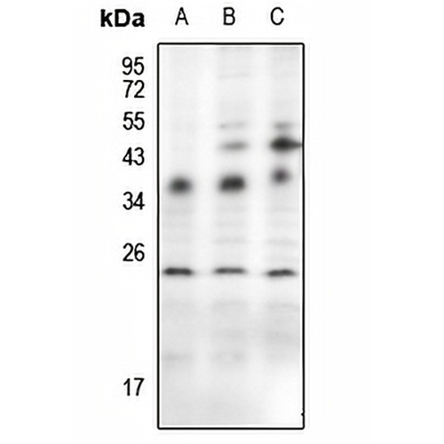 Von Hippel Lindau Rabbit Polyclonal Antibody