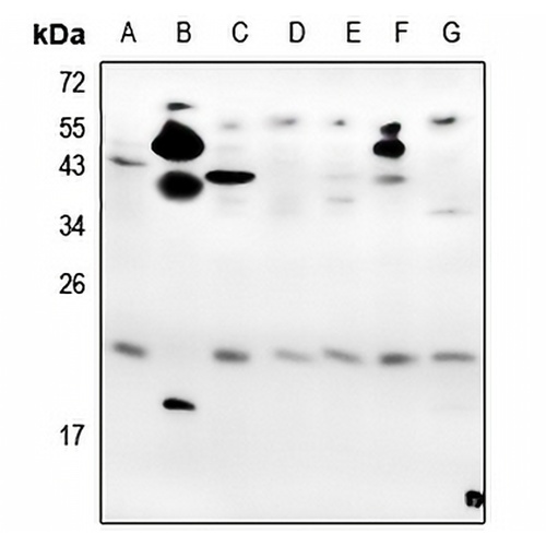 VEGF165 Rabbit Polyclonal Antibody