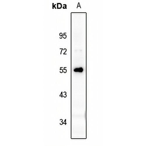 XRCC4 Rabbit Polyclonal Antibody