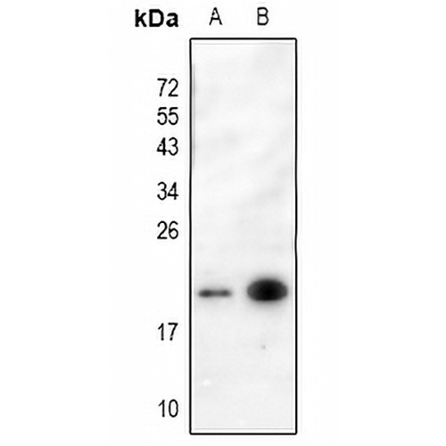 p19 INK4d Rabbit Polyclonal Antibody