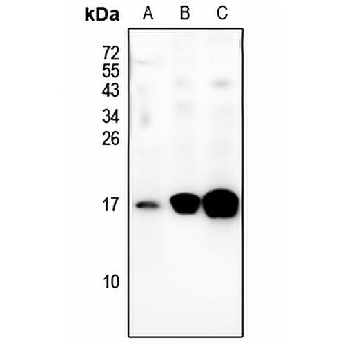 BLCAP Rabbit Polyclonal Antibody